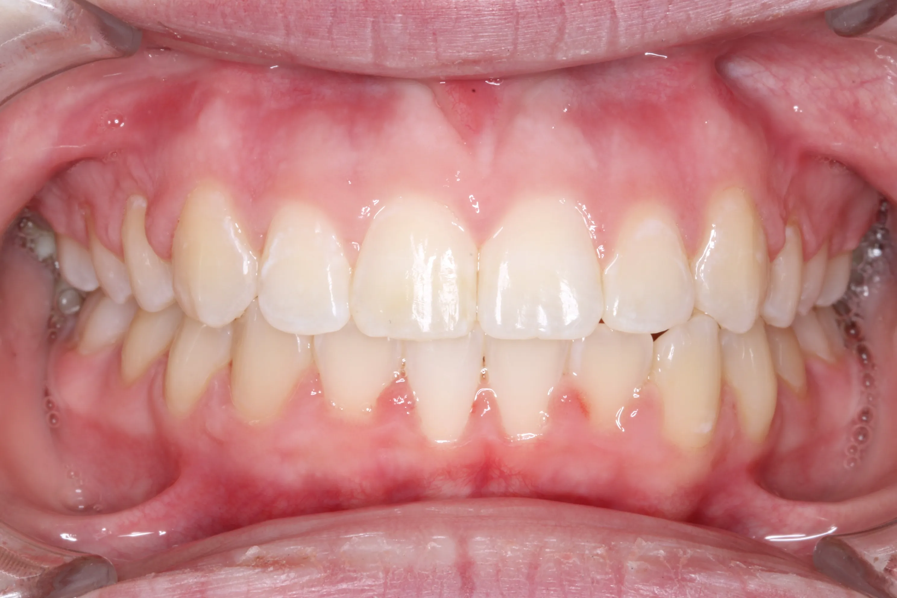 smile-gallery gallery